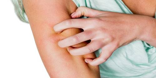 Suffering from Skin Allergy? Try These Effective Natural Remedies