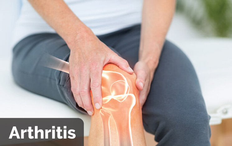 10 Things You Must Know About Arthritis﻿