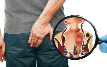 Main Cause Of Piles (Hemorrhoids)