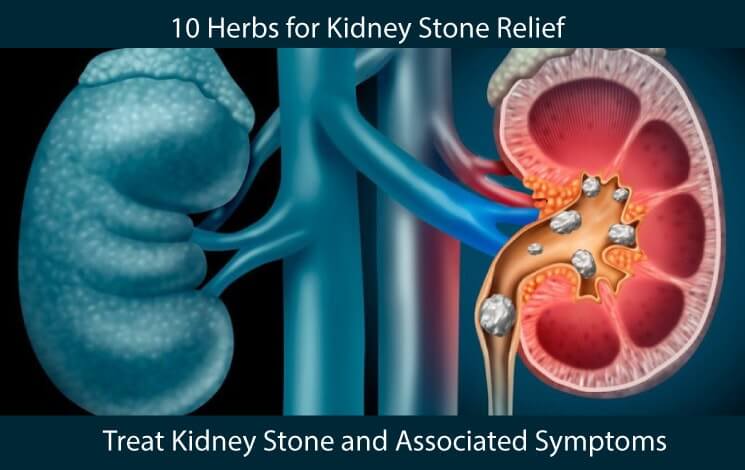 10 Most Effective Herbs to Treat Kidney Stone and Associated Symptoms